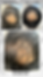 Before and after PRP hair loss treatment for men in Kitchener-Waterloo.