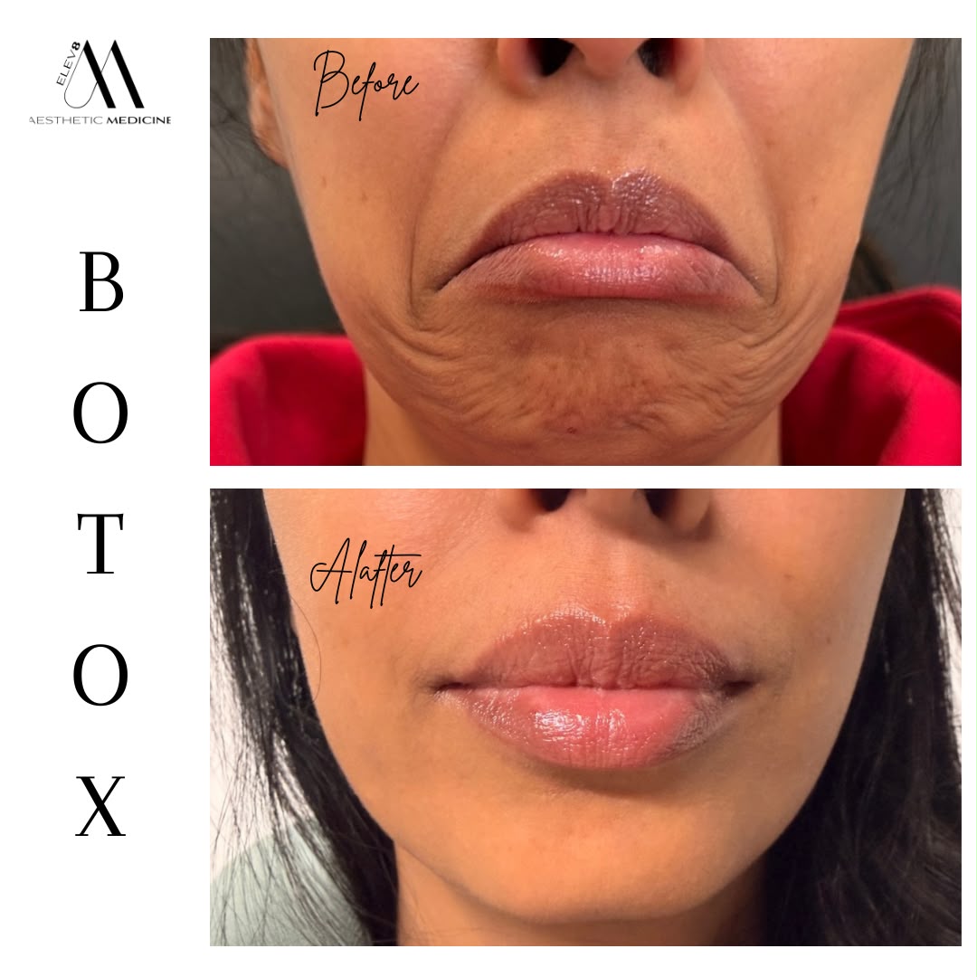 Hair rejuvenation treatment detail