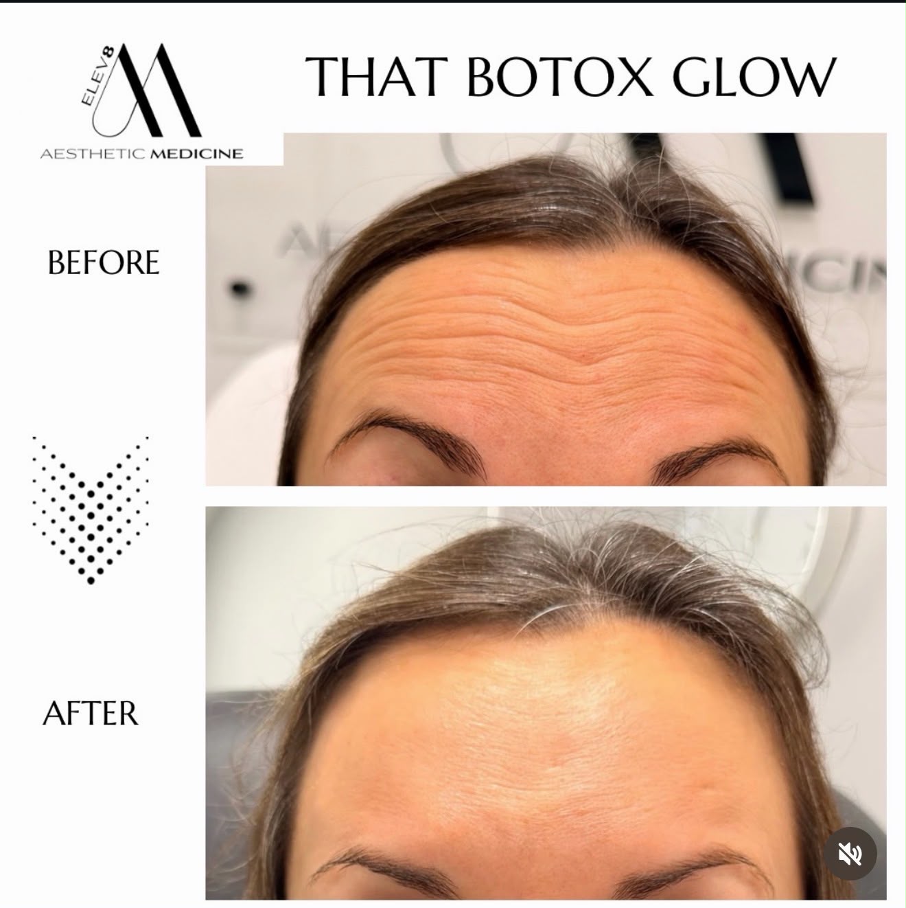 Hair rejuvenation treatment detail