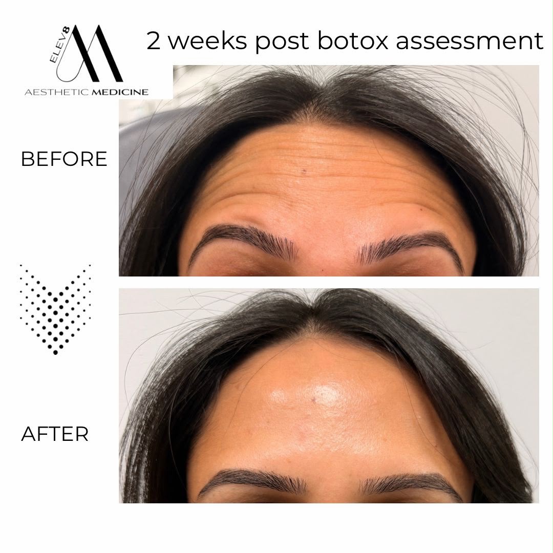 Hair rejuvenation treatment detail