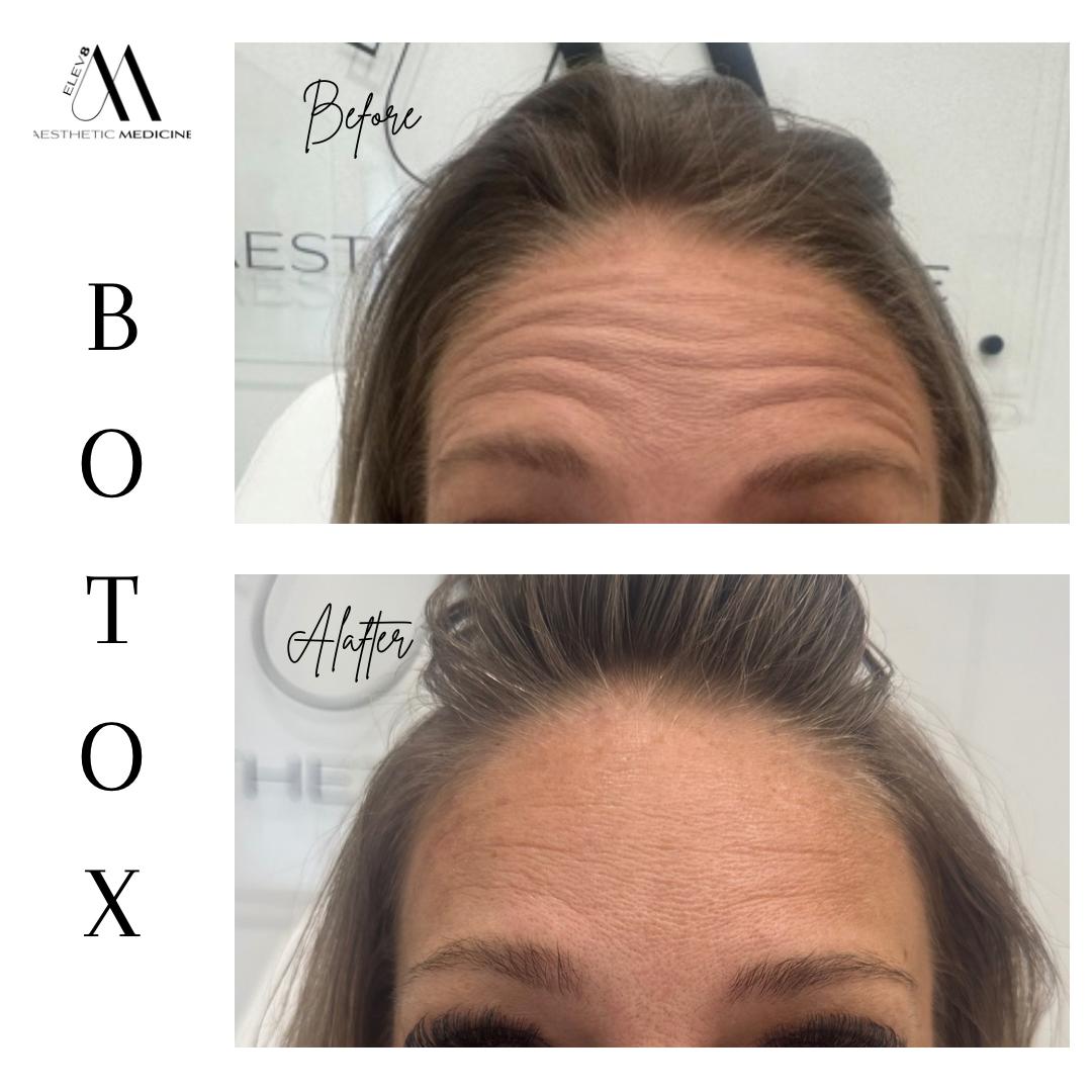Hair rejuvenation treatment detail